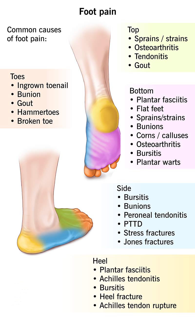 Foot Pain | Yonge Foot Clinic & Orthotics